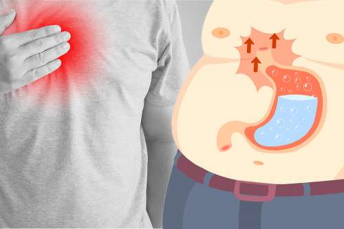 Qu’est-ce que le reflux gastro-oesophagien ?