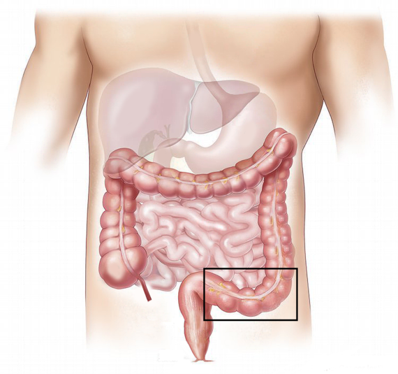 chirurgie digestive Tunisie