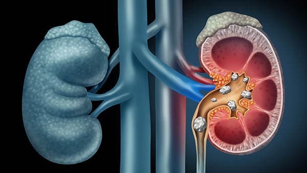 urologie tunisie urologie Tunisie